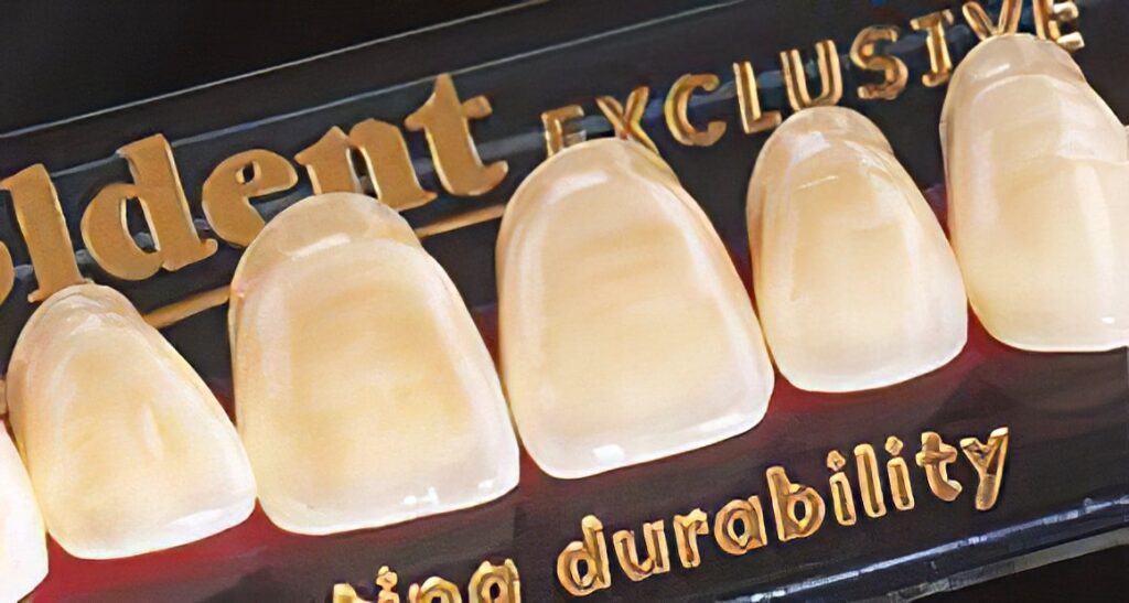 Goldent Exclusive Gigapixel Denti Goldent Exclusive